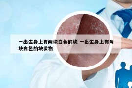 一出生身上有两块白色的块 一出生身上有两块白色的块状物
