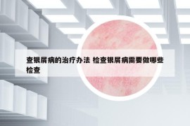 查银屑病的治疗办法 检查银屑病需要做哪些检查