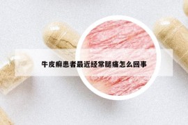 牛皮癣患者最近经常腿痛怎么回事