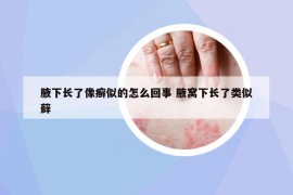 腋下长了像癣似的怎么回事 腋窝下长了类似藓