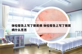 体检报告上写了银屑病 体检报告上写了银屑病什么意思