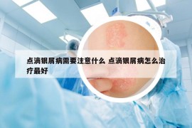 点滴银屑病需要注意什么 点滴银屑病怎么治疗最好