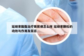 延胡索酸脂治疗银屑病怎么样 延胡索颗粒的功效与作用及禁忌
