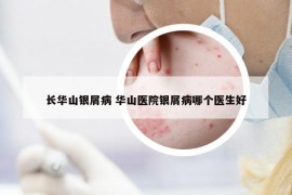 长华山银屑病 华山医院银屑病哪个医生好