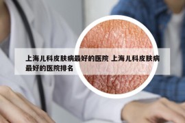 上海儿科皮肤病最好的医院 上海儿科皮肤病最好的医院排名