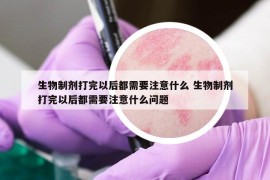 生物制剂打完以后都需要注意什么 生物制剂打完以后都需要注意什么问题