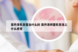 苗丹清乳膏是治什么的 苗丹清抑菌乳膏涂上什么感觉