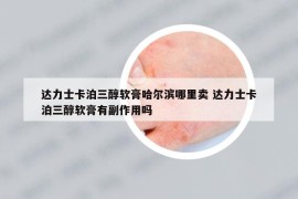 达力士卡泊三醇软膏哈尔滨哪里卖 达力士卡泊三醇软膏有副作用吗