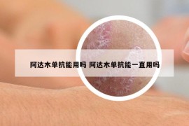 阿达木单抗能用吗 阿达木单抗能一直用吗