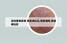 深读君银屑病 银屑病论坛,银屑病吧,银屑病社区