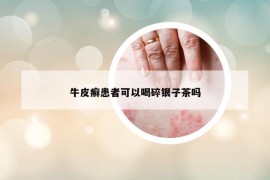 牛皮癣患者可以喝碎银子茶吗