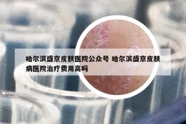 哈尔滨盛京皮肤医院公众号 哈尔滨盛京皮肤病医院治疗费用高吗