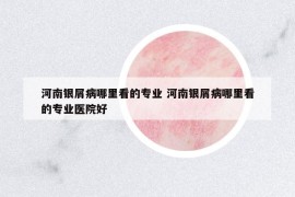 河南银屑病哪里看的专业 河南银屑病哪里看的专业医院好