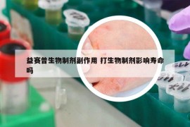 益赛普生物制剂副作用 打生物制剂影响寿命吗