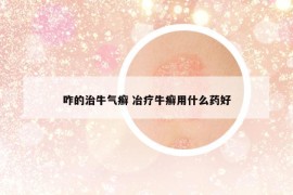 咋的治牛气癣 冶疗牛癣用什么药好