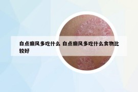 白点癫风多吃什么 白点癫风多吃什么食物比较好