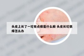 头皮上长了一坨有点痒是什么癣 头皮长坨很痒怎么办