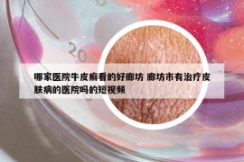 哪家医院牛皮癣看的好廊坊 廊坊市有治疗皮肤病的医院吗的短视频