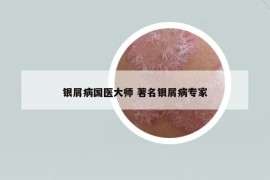 银屑病国医大师 著名银屑病专家