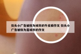 街头小广告被称为城市的牛皮癣作文 街头小广告被称为是城市的作文