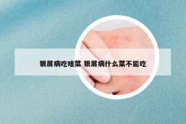 银屑病吃啥菜 银屑病什么菜不能吃