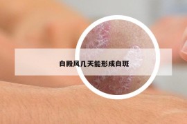 白殿风几天能形成白斑