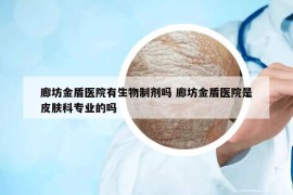 廊坊金盾医院有生物制剂吗 廊坊金盾医院是皮肤科专业的吗