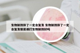 生物制剂停了一定会复发 生物制剂停了一定会复发银屑病打生物制剂好吗