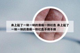 身上起了一块一块的像癣一样红色 身上起了一块一块的像癣一样红色不疼不痒