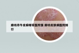 廊坊市牛皮癣哪家医院强 廊坊皮肤病医院排行
