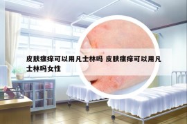 皮肤瘙痒可以用凡士林吗 皮肤瘙痒可以用凡士林吗女性