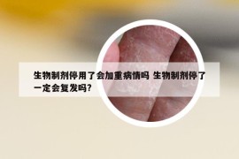 生物制剂停用了会加重病情吗 生物制剂停了一定会复发吗?