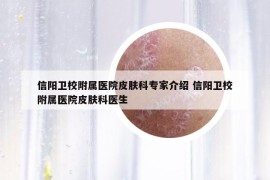 信阳卫校附属医院皮肤科专家介绍 信阳卫校附属医院皮肤科医生