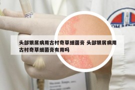头部银屑病用古村奇草细菌膏 头部银屑病用古村奇草细菌膏有用吗