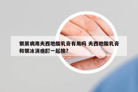 银屑病用夫西地酸乳膏有用吗 夫西地酸乳膏和银冰消痤酊一起擦?