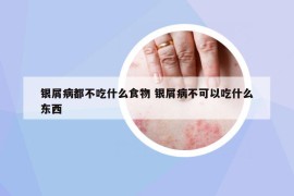 银屑病都不吃什么食物 银屑病不可以吃什么东西
