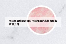 强生银屑病能治根吗 强生银鑫汽车销售服务有限公司