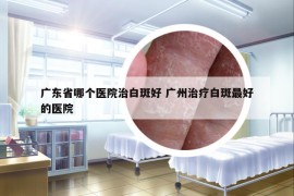 广东省哪个医院治白斑好 广州治疗白斑最好的医院