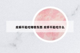 皮癣不能吃哪些东西 皮疹不能吃什么