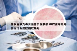 神农百草九毒膏治什么皮肤病 神农百草九毒膏治什么皮肤病效果好