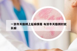 一到冬天胳膊上起癣摸着 每到冬天胳膊肘就长癣