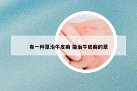 有一种草治牛皮癣 能治牛皮癣的草