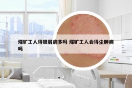 煤矿工人得银屑病多吗 煤矿工人会得尘肺病吗