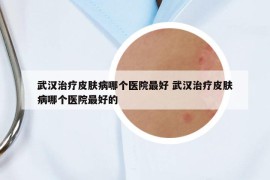 武汉治疗皮肤病哪个医院最好 武汉治疗皮肤病哪个医院最好的