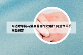 阿达木单抗与益赛普哪个效果好 阿达木单抗跟益赛普