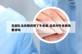 在部队当兵期间得了牛皮癣 当兵对牛皮癣有要求吗