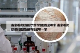 南京看皮肤病比较好的医院是哪家 南京看皮肤病的医院最好的是哪一家