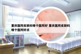 重庆医院皮肤科哪个医院好 重庆医院皮肤科哪个医院好点