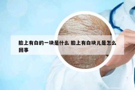 脸上有白的一块是什么 脸上有白块儿是怎么回事
