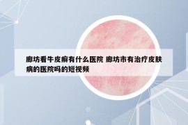 廊坊看牛皮癣有什么医院 廊坊市有治疗皮肤病的医院吗的短视频